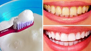 10 Natural Ways to Whiten Teeth at Home [upl. by Seebeck]