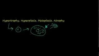 2  Introduction to pathology  hypertrophy hyperplasia [upl. by Artcele]