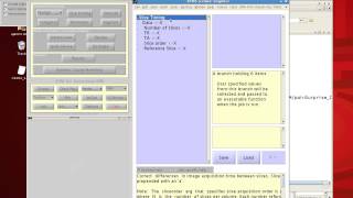 SPM Tutorial 1 Intro to SPM [upl. by Enirehs]