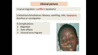 24 Nematodes revision  Dr Noha Madbouly [upl. by Fahy]