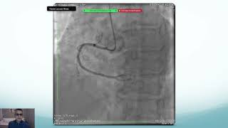 CARDIOLOGIA INTERVENCIONISTA 2024  ANATOMIA E PROJEÇÕES [upl. by Ylle]