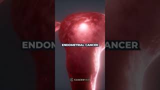 FDA Approves New Immunotherapy Treatment for Endometrial Cancer [upl. by Omoj]