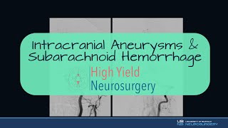 Intracranial Aneurysms amp Subarachnoid Hemorrhage [upl. by Hudnut91]