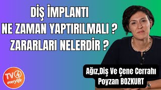 Diş İmplantı Bilmemiz Gerekenler [upl. by Afira]