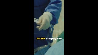 Transient Ischemic Attack Surgery shorts [upl. by Akoyin]