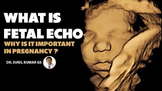 What is Fetal Echo amp Why is it Important in Pregnancy  fetalechocardiography pregnancy health [upl. by Maribel]