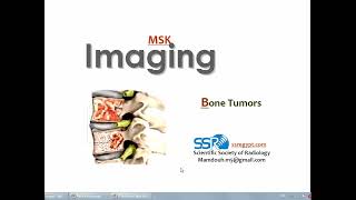 Imaging of Bone tumors I DRE Prof Mamdouh Mahfouz [upl. by Un]