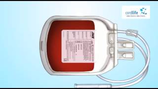 Cordlife Cord Blood Collection Process [upl. by Gallard67]