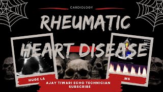 RHEUMATIC HEART DISEASERHDCardiology [upl. by Sell]