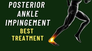 Posterior Ankle Impingement Exercises  Os Trigonum Treatment [upl. by Hwu]