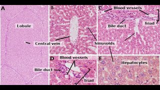 Histology of Liver components  Parenchyma Stroma Sinusoids space of disse Hepatocytes [upl. by Meghann]