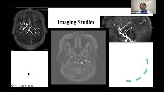 Sub Intern Case Presentations November 6th 2024 [upl. by Gies]