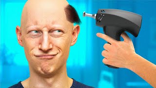 Top 5 NEW Hair Restoration Treatments YOU Need To Know About [upl. by Bigg860]