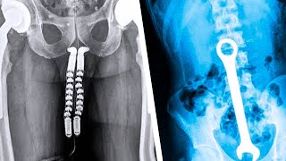 20 Strangest Things Discovered by XRays [upl. by Thielen]