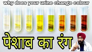 पेशाब का रंग  Urine color changed Know why DREDUCATION Hindi [upl. by Brecher]