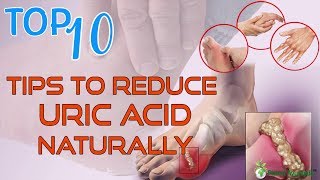 Top 10 Tips To Reduce Uric Acid Naturally  Home Remedies for Gout Treatment [upl. by Kerwin]