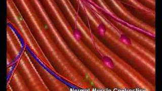 Mechanism of Botulinum Toxin [upl. by Zippora]