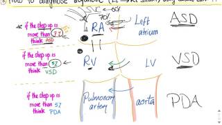 How to diagnose acyanotic heart diseases Left to Right shunt via Cardiac Catheterization [upl. by Sheley]