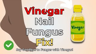 Vinegar for Nail Fungus Treatment How to Use It Effectively at Home [upl. by Marteena494]