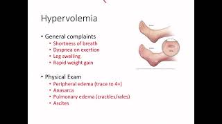 Hypovolemia and Hypervolemia [upl. by Atinram]