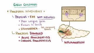 Cystic fibrosis causes symptoms diagnosis treatment amp pathology [upl. by Atiuqam]