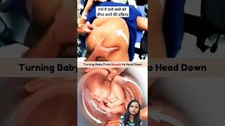 turning baby from breech to head down sandhyahealth  ulate bachhe ko shidha kaise kare [upl. by Ohare345]