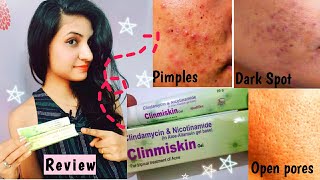 Clinmiskin UsagesBenifitsSide Effects  For Pimples Dark Spot and Open Pores [upl. by Richardo]