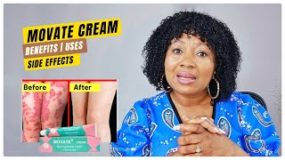 MOVATE SKIN LIGHTENING CREAM amp Skin Bleaching  BENEFITSUSESSIDE EFFECTS [upl. by Recneps]