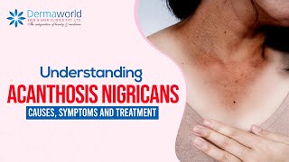 Understanding Acanthosis Nigricans Causes Symptoms and Treatment [upl. by Horan]