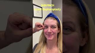 SKIN PINCH Lower Blepharoplasty [upl. by Nevart]