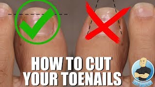 BEST Toenail Fungus Treatment 2024 4 BIG SECRETS [upl. by Elolcin116]