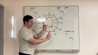 Two minute axis deviation made easy [upl. by Moorefield755]