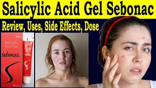 Salicylic Acid Gel Sebonac  Salicylic Acid Gel Review  uses Side Effects Dose How to use [upl. by Dowzall753]