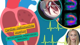 Cardiac radionuclideimaging [upl. by Atima]