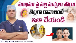 Best Treatment for Tanned Skin  How to Get Rid of Tanned Skin Naturally  Celestee Skin Clinic [upl. by Fischer]