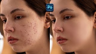 Skin Retouching in Photoshop  Tutorial For Beginners [upl. by Arnuad419]