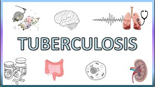 Tuberculosis  Types Pathogenesis Signs and Symptoms Diagnosis Treatment and Prevention [upl. by Yardna]