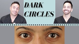 Dark Circles Causes amp Treatments  Dermatologist Perspective [upl. by Hindu]