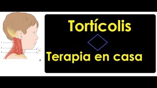 Tortícolis congénita tensión en cuello  Terapia en casa [upl. by Dulcle80]