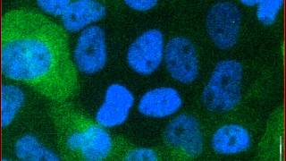 Mitotic catastrophe triggered in human cancer cells by the viral protein apoptin  movie A [upl. by Marozik]