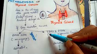 pathogenesis of thyroid cancer NGMedicals [upl. by Kellen]