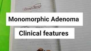 Monomorphic Adenoma salivaryglands [upl. by Rolyat493]