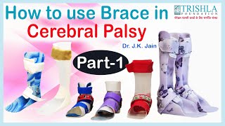 How to use BraceOrthosisAFOSpecial Shoe in Children with Cerebral Palsy  Part 1  Trishla [upl. by Erialcyram]