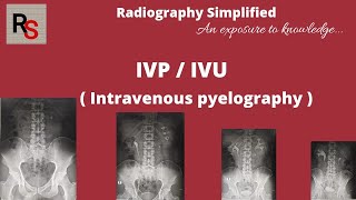 IVP ll Intravenous pyelography ll Intravenous urography ll Radiography simplified ll [upl. by Pantheas]