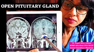 👉 HEIGHT GROWTH HOW TO OPEN PITUITARY GLAND NATURALLY Increase HGH Release Dr Rupal [upl. by Heathcote782]