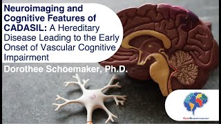 Neuroimaging and Cognitive Features of CADASIL [upl. by Mcnamee445]