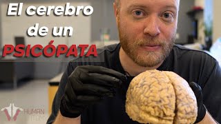 Dentro del CEREBRO de un PSICÓPATA [upl. by Alimat678]