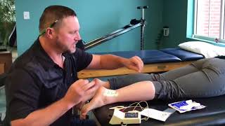 Iontophoresis in Physical Therapy [upl. by Baler]