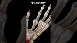 DEDO EN GATILLO 🤚🏼 dedo traumatología ortopedia doctor salud bienestar orthopedics [upl. by Al]