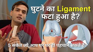 घुटने का Ligament फटा हुआ है 5 संकेत जो आप घर पर ही पहचान सकते हैं [upl. by Atteval]